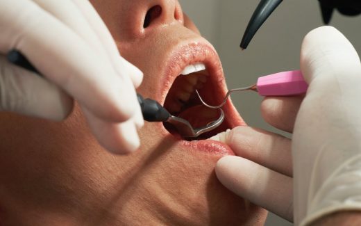 En tandläkare för din trygghet i Sollentuna